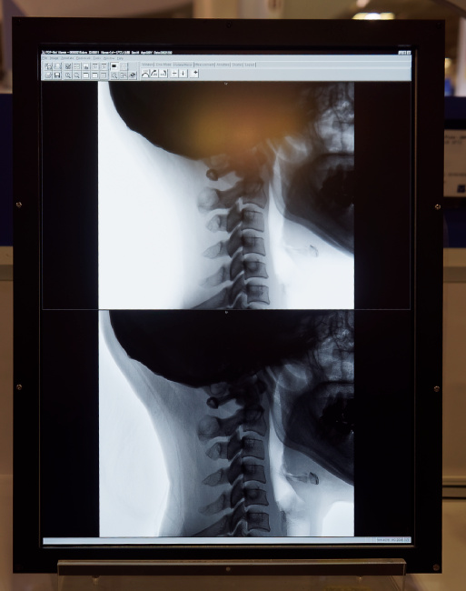 Tianma 6MP Medical panel