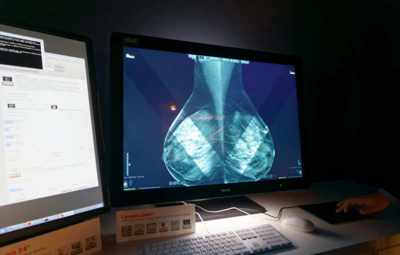 Barco Mammogram V